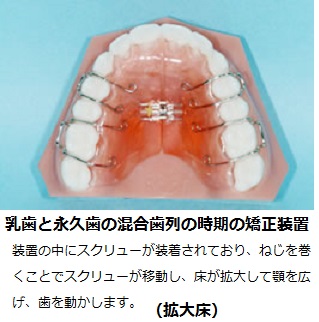 矯正ってしたほうがいいの？