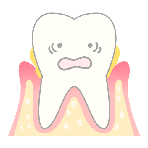 歯周病の原因や症状、治療法を解説