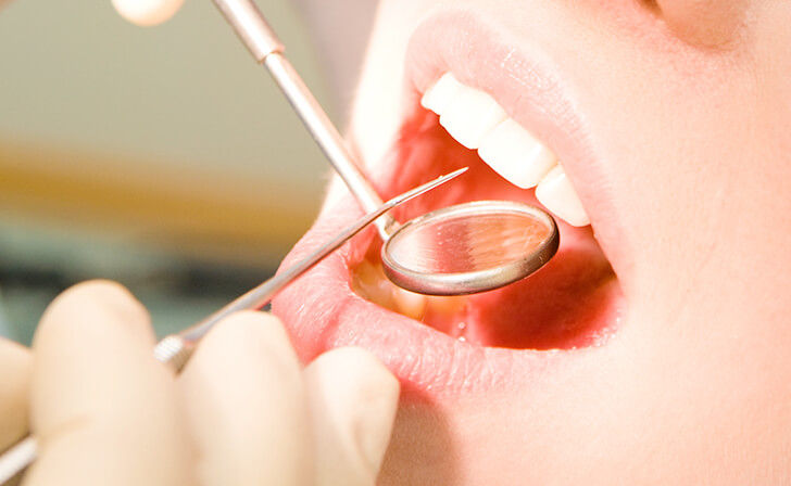 健康な歯を守るための予防歯科を推奨